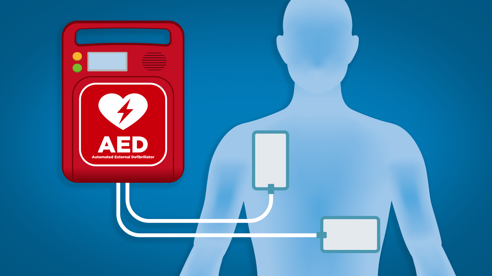 AEDs: Accessible Emergency Device That Saves Life