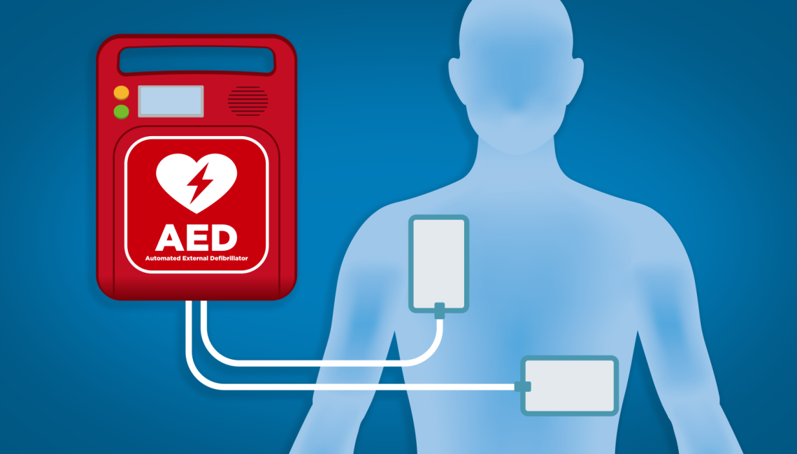 AEDs: Accessible Emergency Device That Saves Life